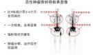 上饒市人民醫院核醫學科骨檢查與治療